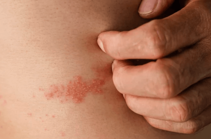 Skin Condition | Vaginal Health | Condom Depot Learning Center